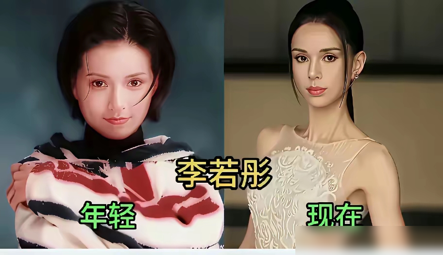 章子怡红毯上那张脸，颧骨支棱着，太阳穴凹进去两个坑，网友直接说瘦脱相了。
拍《酱园弄》狂掉7斤，制片人说她每天就灌一碗流食，哭戏拍到一半低血糖，人差点栽地上。早年拍《一代宗师》，更是瘦到84斤，肋骨一根根看得清清楚楚。
再看国外，A妹也是，脸颊越凹越深，锁骨支棱得吓人。现在网友早就不夸自律了，都