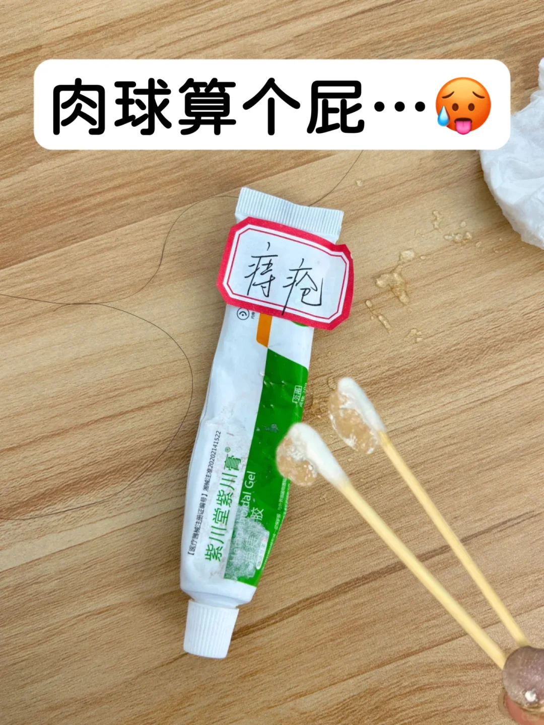 痔疮党的命是这个小绿管给的。。。。。