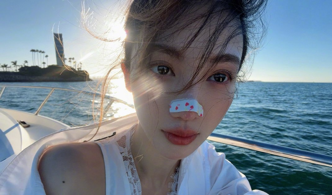金晨的鼻子是咋回事，贴了一个这么大的创可贴…… ​