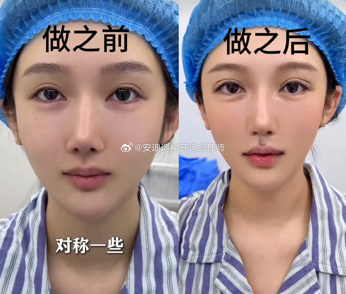 #都美竹 医美#
刀修皮相，难改争议！马脸鼻长，伎俩非常，一切都为名利打算。低配的女孙宇晨！ ​