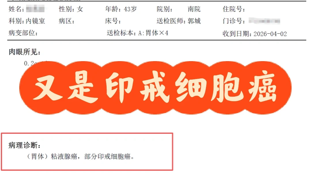 印戒，又是印戒！