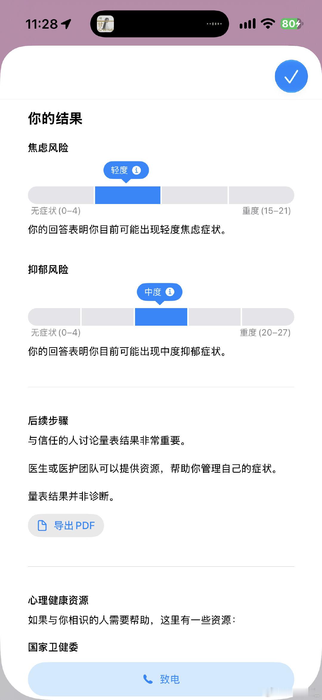 最近一段时间体验了Apple Watch Series12全新一代的心率传感硬件🫀，

新的「生命体征」功能真的很有意思，

手表会持续采集数据，
慢慢建立属于我个人的健康基线
可以查看心率、血氧、体温、呼吸频率的波动区间，
一目了然，
这个功能对于我们亚健康人群来说，非常刚需了。
#applewatchseries12# ​