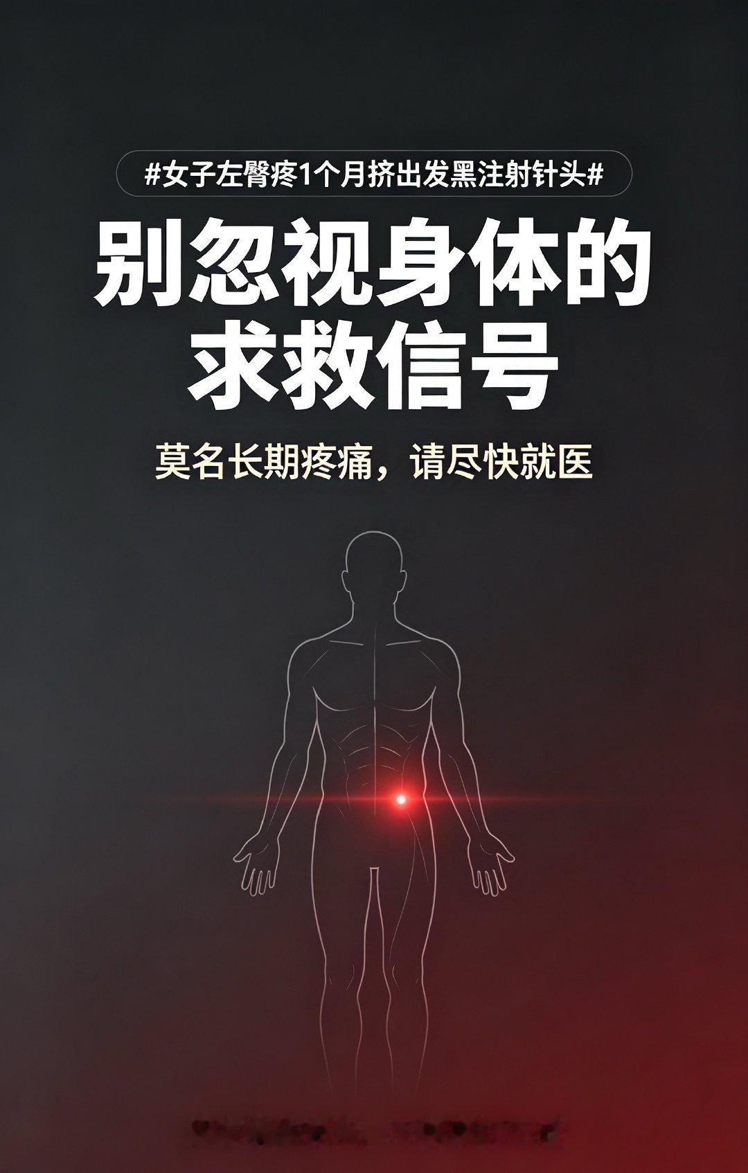 #女子左臀疼1个月挤出发黑注射针头#
误以为肌肉拉伤疼了一个月，洗澡挤出4cm生锈黑针头⚠️
减肥脂肪变薄，藏在臀里的异物终于发作，针头来源仍是谜。
身体持续疼痛不要硬撑！ ​