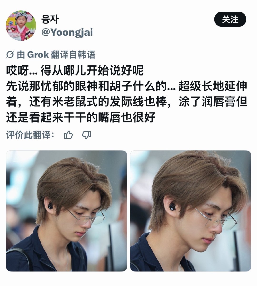米老鼠式发际线asfvhddvjkmzz 然后我又想到他英文名叫micky ​