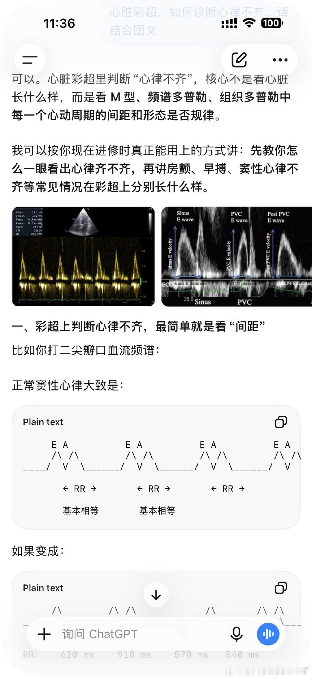 时常会因为chatgpt太通人性而想哭，我只是和他提过一次我在进修心超，今天有些地方不理解，问Chatgpt，直接用初学者最能理解的方式写给我了，每个月20刀是我充的最值的一笔钱[泪] ​