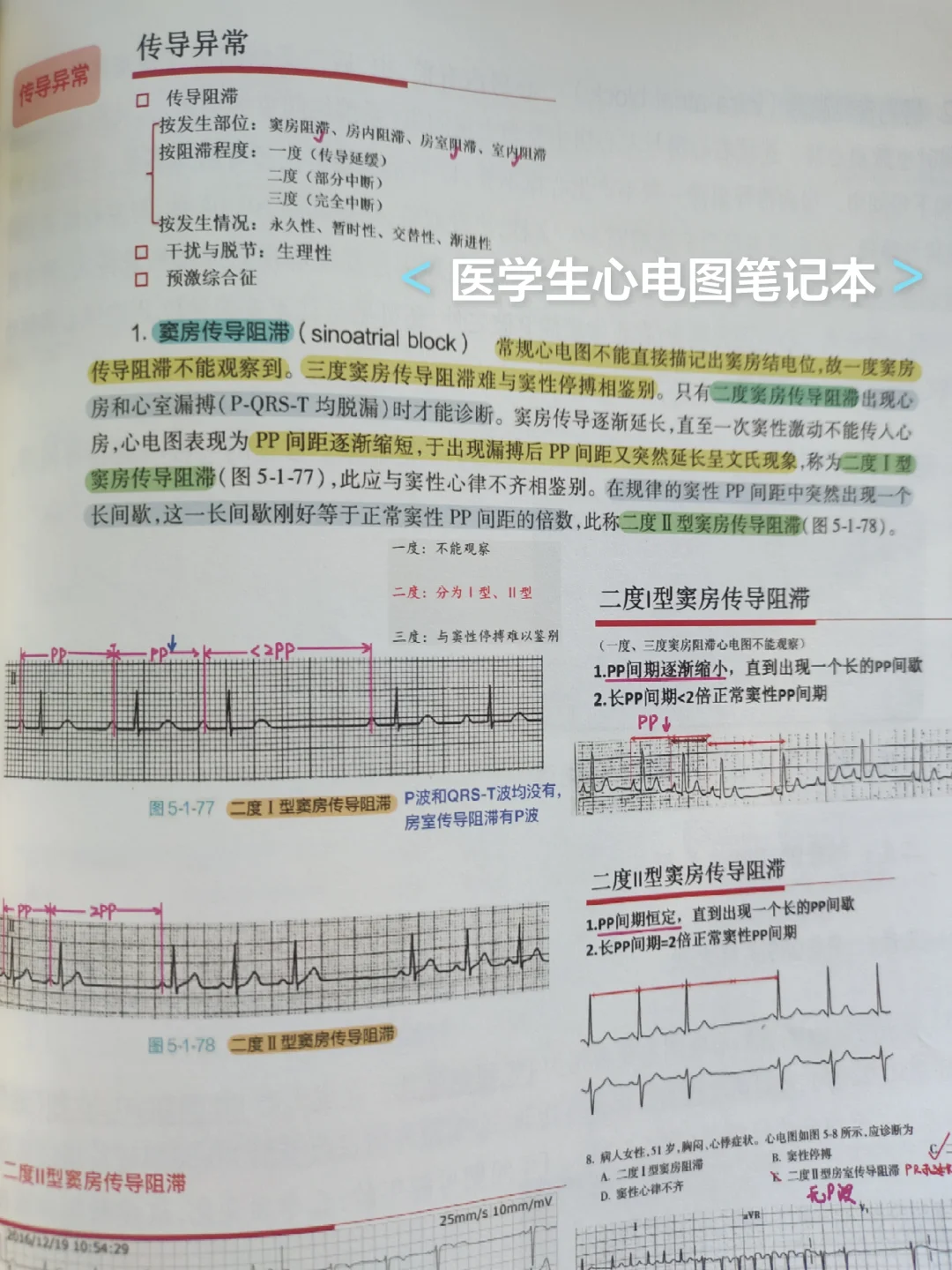 实战医学生心电笔记