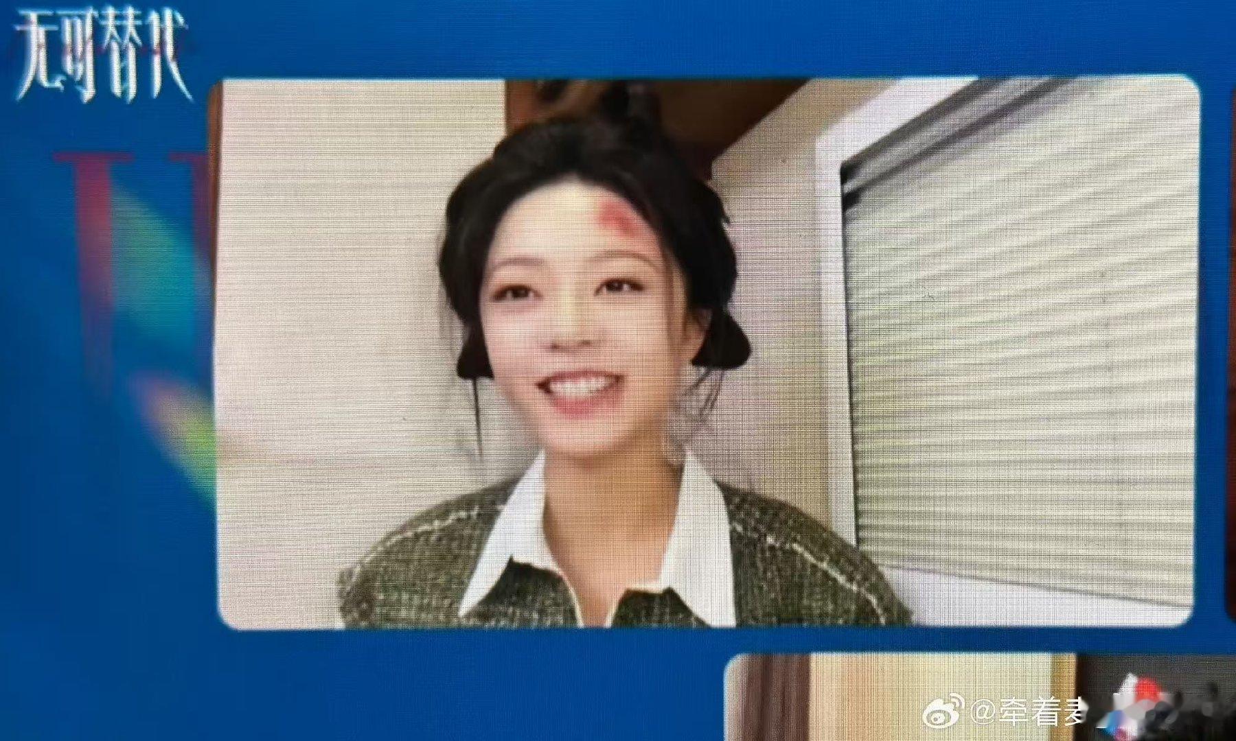 #赵今麦顶着受伤妆就来直播了# 赵今麦顶着受伤妆直播，脸上青一块紫一块的还笑得那么开心，这反差也太可爱了。 ​