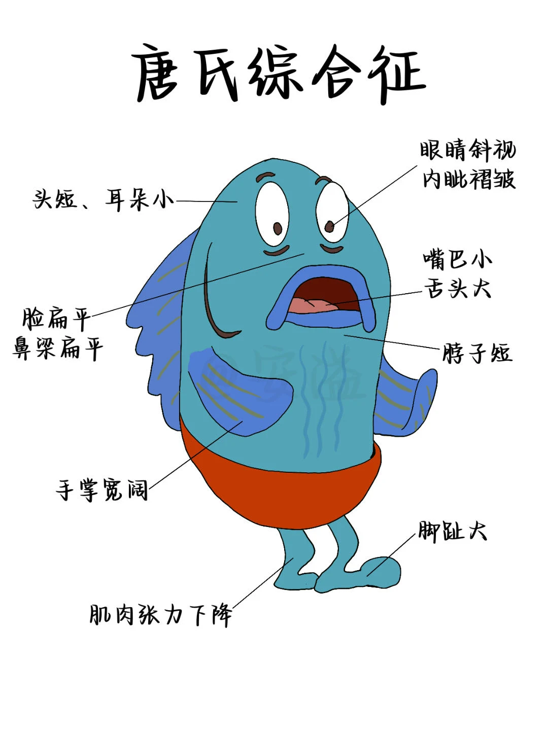 医学生绘本‖唐氏综合征