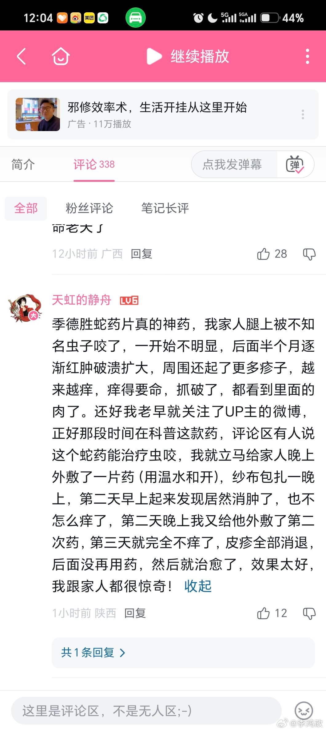 季德胜蛇药片真的神药，我家人腿上被不知名虫子咬了，一开始不明显，后面半...