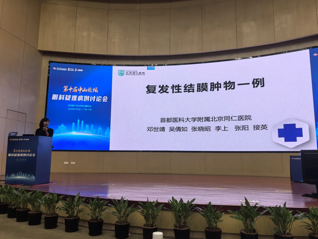 今天在第十届中山论坛眼科疑难病例讨论会上，分享了《复发性结膜肿物一例》的病例~