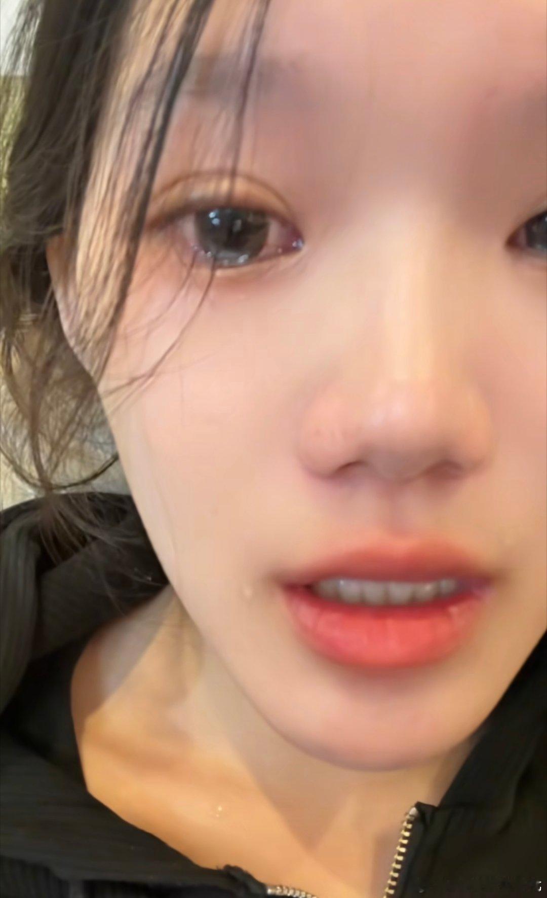 正颌手术翻车！含泪发声后突然道歉，一纸和解声明背后细思极恐🔥
 
满怀期待做正颌手术，本想换来容貌与咬合的改善，最后却迎来手术失败的结局。
 
女孩最初含泪出镜，哭诉自己遭遇，对外宣告维权成功，无数网友心疼她的遭遇，为她的胜利叫好。
 
可反转来得猝不及防！不过短短数日，盖着手印的官方 ​