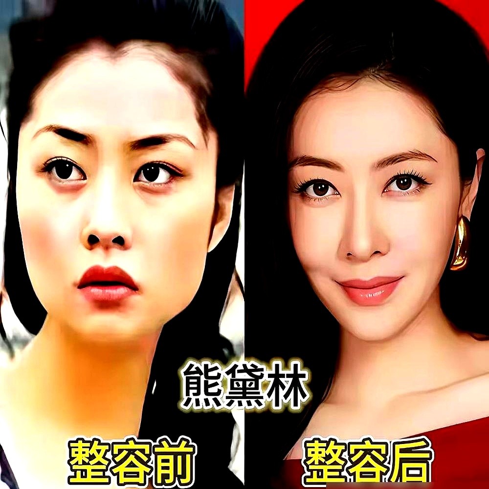 沈梦辰连做四年热玛吉把脸做薄，谢楠旧照被扒底朝天，评论区竟然全是夸的。

沈梦辰没藏着掖着，直接把做医美的老底掀了。别人拼命往脸上填东西求幼态，她硬是反着来，留着凹陷，专挑皮贴骨的冷厉感整。

另一边谢楠当年的选秀照被人翻出来逐帧对比，五官变化一目了然。搁别人遇到这事早急眼了，结果这两位硬是靠审美抗
