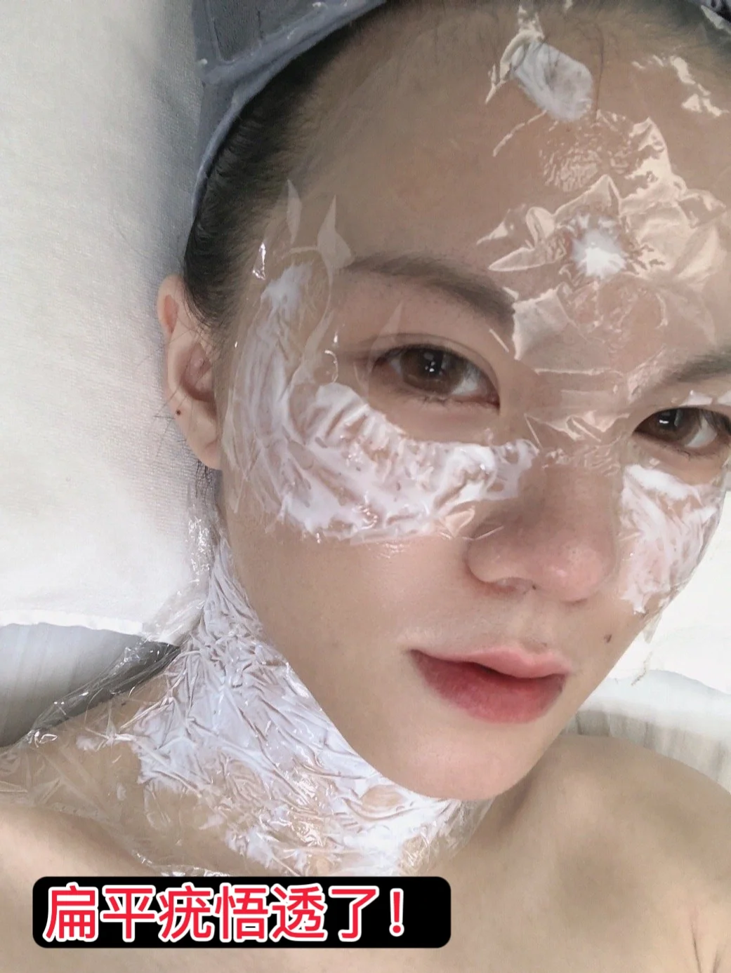 真心想劝有扁平疣的姐妹们做好这几件事！