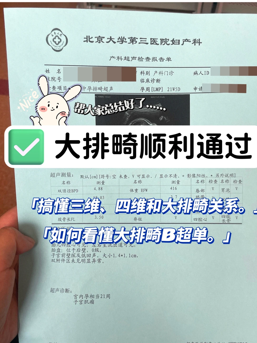 三维、四维与大排畸的关系？B超指标解读