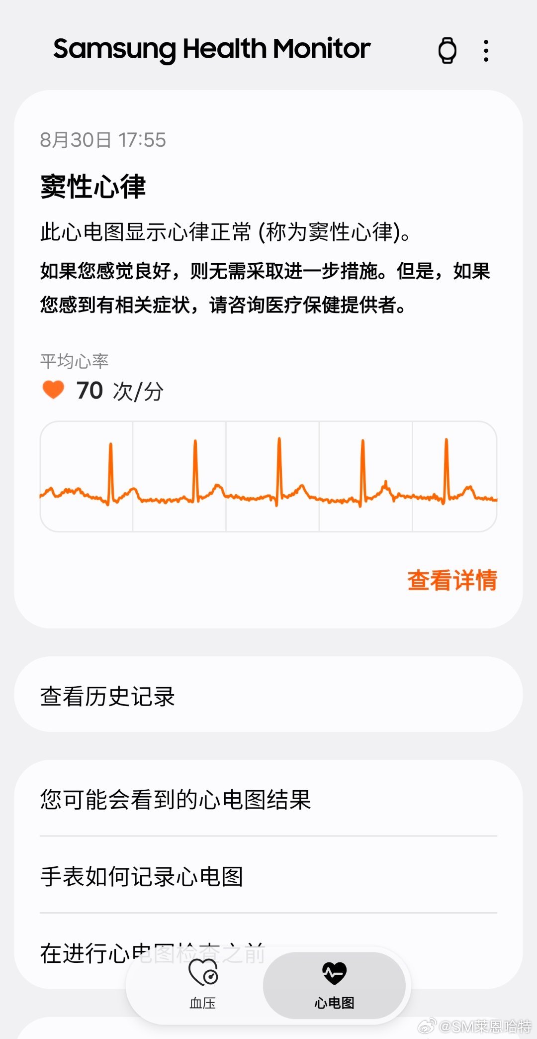 #三星[超话]# 近期使用Galaxy Watch4(医疗器械2级认证）进行健康监测，设备记录到心率数值处于正常区间，同步生成的心电图报告显示窦性心律状态。监测结果明确心律正常，若身体无不适则无需额外处理，若存在相关症状可咨询医疗机构。  ​