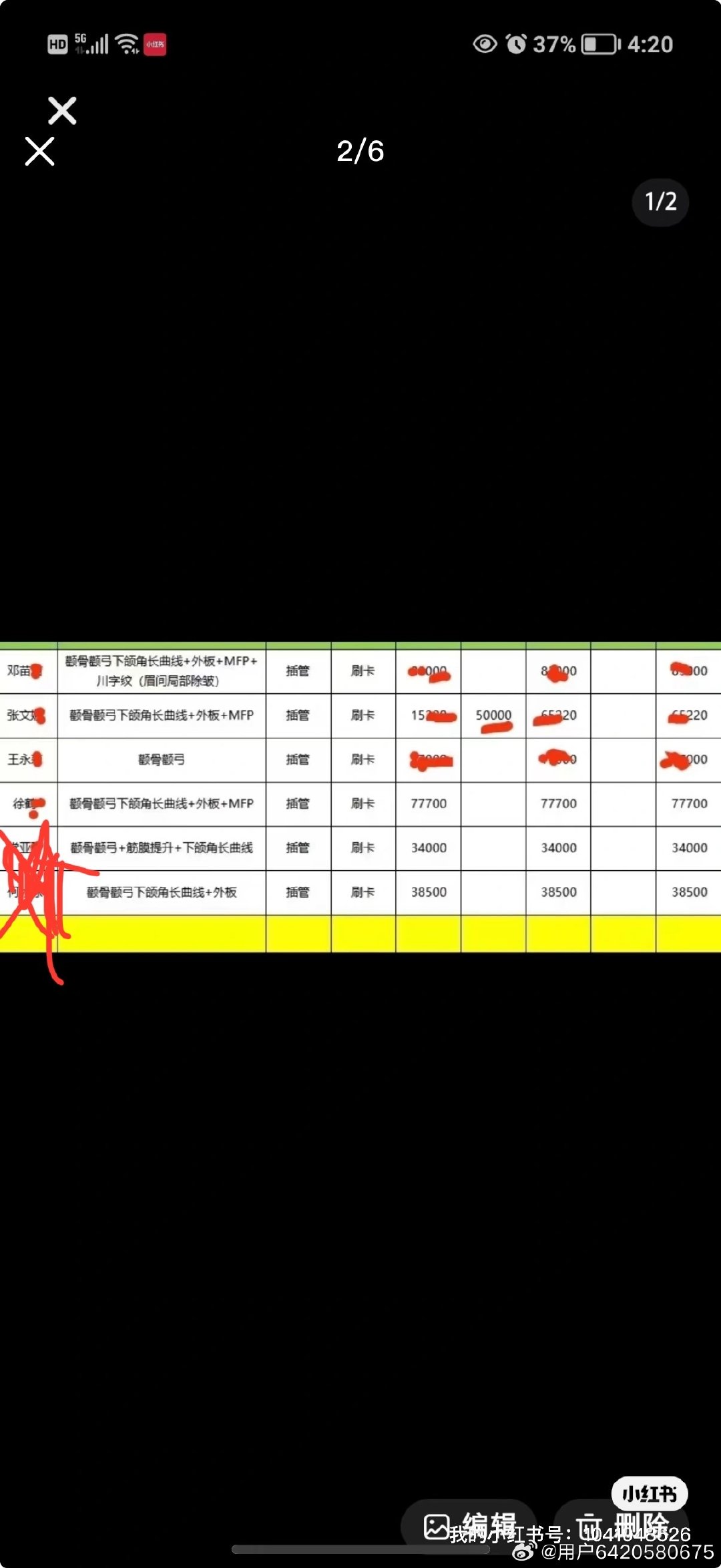 壁垒上海韩国蘑🍄金……  弄的凹凸不平，大小脸，还乱收费，看人下菜碟，底下团队态度差，还拉黑不处理，具体的想知道私信跟我了解～ …… ​