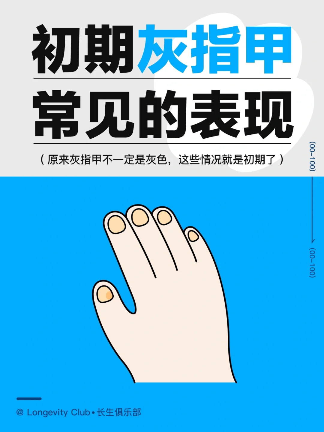 初期灰指甲常见的表现