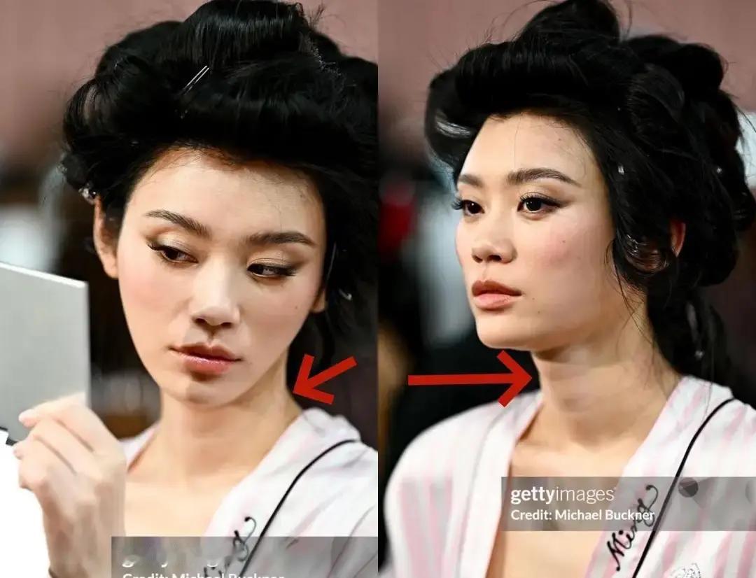 背着几英尺大翅膀走完维密的奚梦瑶，卸了力在后台随手拍了张生图，脖子上的褶子一条都没修就直接发了出来。
很多女人为了脖子上那两道纹路焦虑得睡不着，买大牌颈霜、做医美项目，结果身家优渥的超模，低头照样是一道道折痕。
她当年就大方承认过，自己这张脸是实打实花了重金的。
可钱花到位了，皮肉再透亮，颈纹
