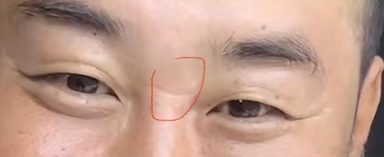 眼睛细长 ➕卧蚕饱满 ➕田宅宫饱满且油润➕眼神平和=知足常乐，心态好，父母缘分深，有祖产，中年事业运、财运较年轻时候有大起色。 但如果如图，山根有横纹➕鱼尾纹分叉且过长，且田宅宫痣多、卧蚕不油，不润，那么该人就容易贪吃好色，赚的钱都用来自己享受了，身边人很难沾光。面相小‬知识手相面相八字算命