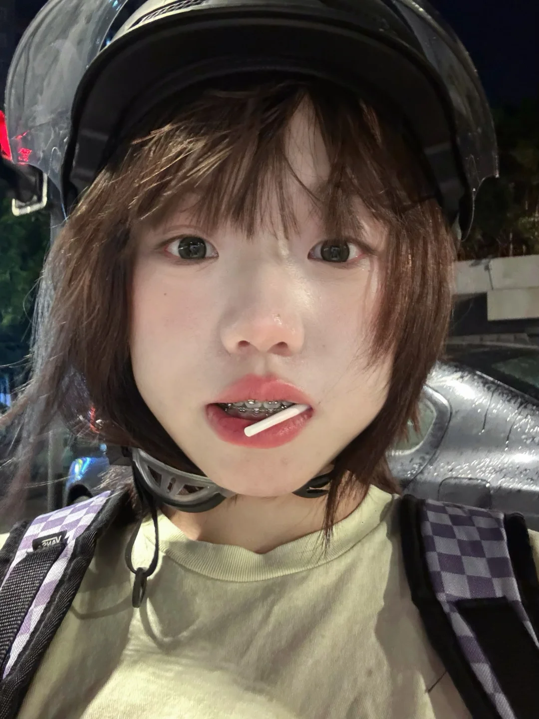 带上钢牙也不耽误吃糖~