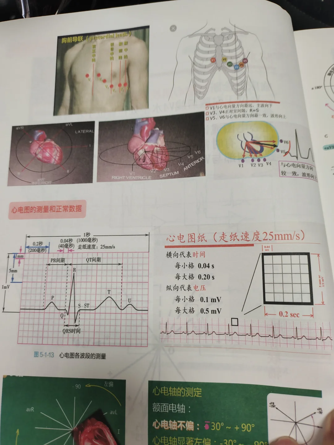 医学生规培心电图学习