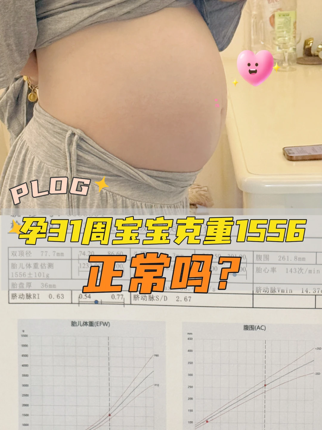 孕31周小排畸报告｜这些数据怎么看？怎么问
