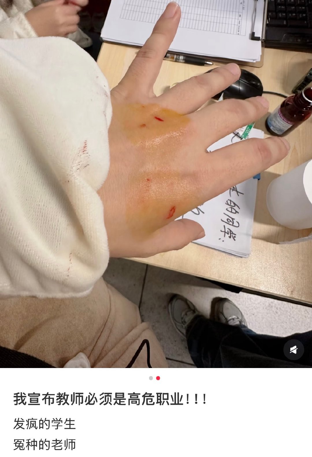 #老师被家长举报要求保证不怀孕#
真的完蛋了……居然要求老师保证不怀孕，各种各样奇葩举报层出不穷，有需求完全可以自己花钱一对一聘请私教专门教自家孩子，要是一直这样下去，老师不敢管不敢教，最后耽误的还不是你家孩子，这样下去看这些人的小孩以后成为什么样的人吧 ​