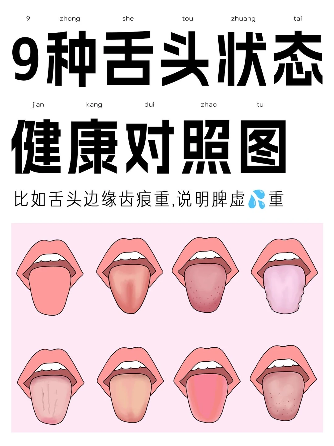 灵光帮你1分钟辨舌苔看体质