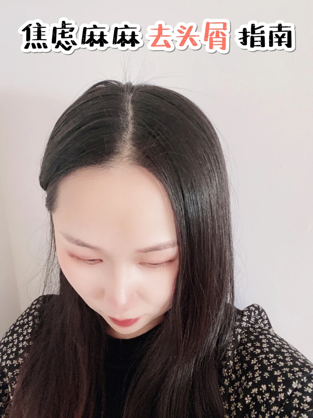 焦虑妈去屑拯救指南！盖章好用我cue它