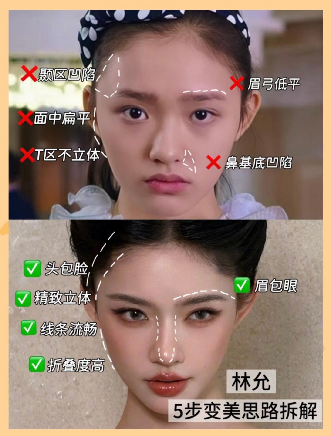 林允和赵晴都是把发量堆到颅颞会好看的类型。林的额头明暗转折能看出额头不窄，这种头型把下颌收紧形成对比会显得很华丽。

我不觉得林允填过，她本身的骨相完成度就是百分百。只是before的五官各长各的，提升对称度、妆容的统一调度（眉眼填满横宽、色彩明暗层层收紧）整个观感就非常好。 ​