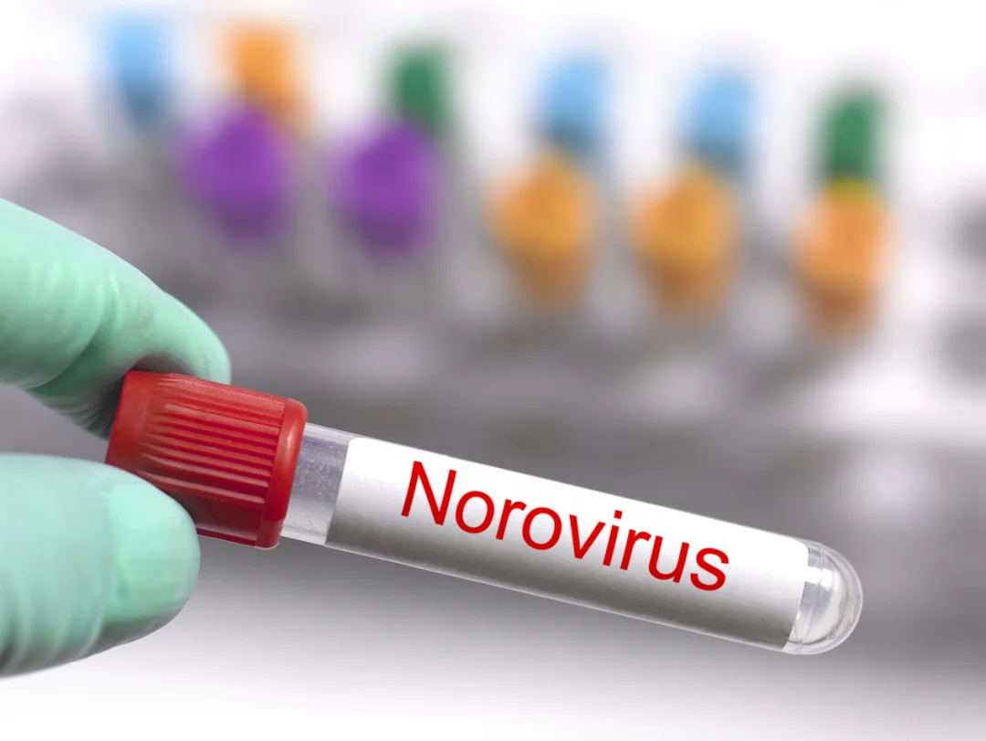 可怕！日本多地发生食物中毒事件