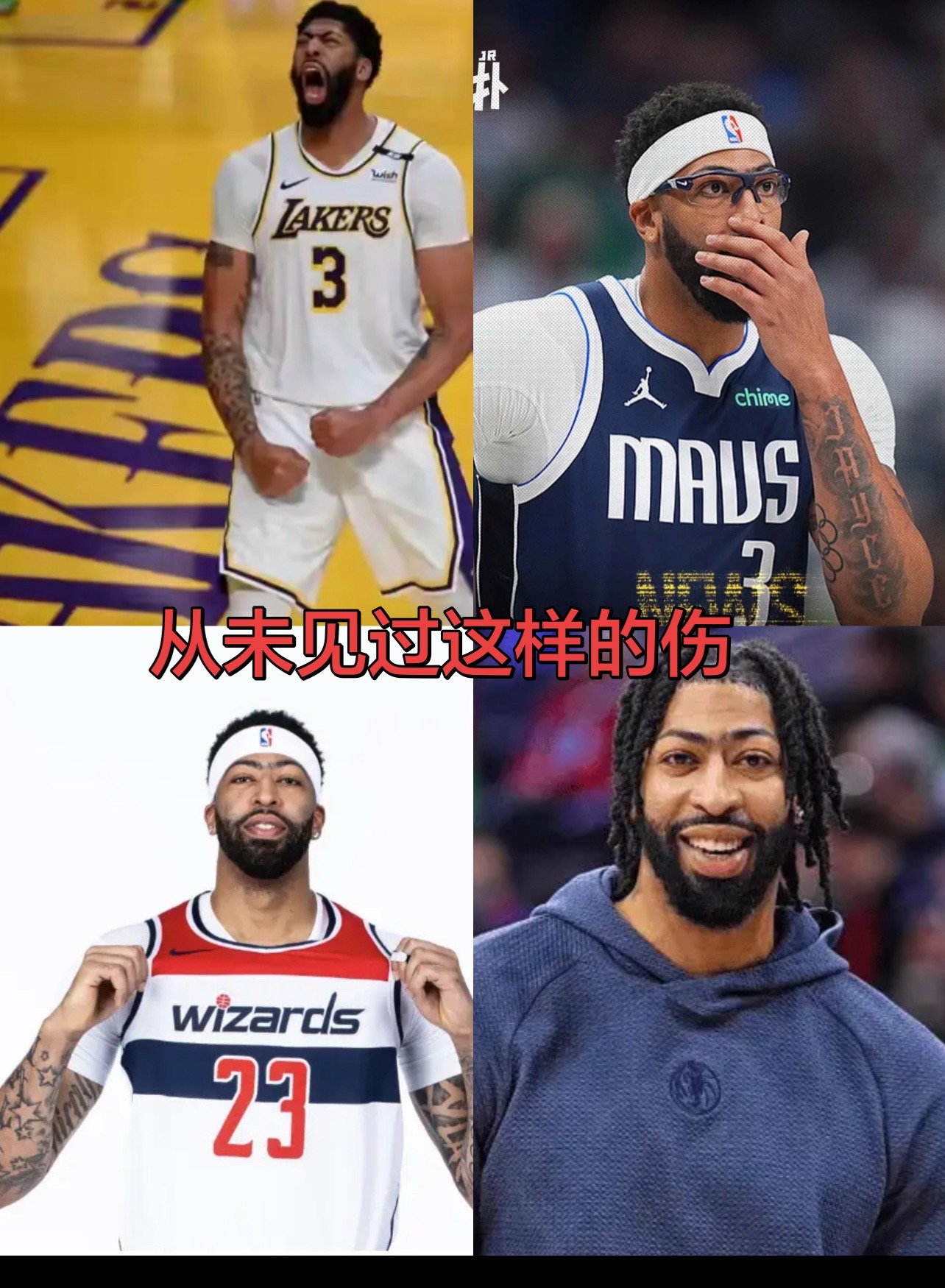 从未见过这种伤。浓眉的伤，究竟有多严重？安东尼-戴维斯的伤病报告更新...