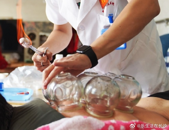 【4种常见的小病最适合拔罐】中医介绍，生活一些“小毛病”最适合拔罐缓解...