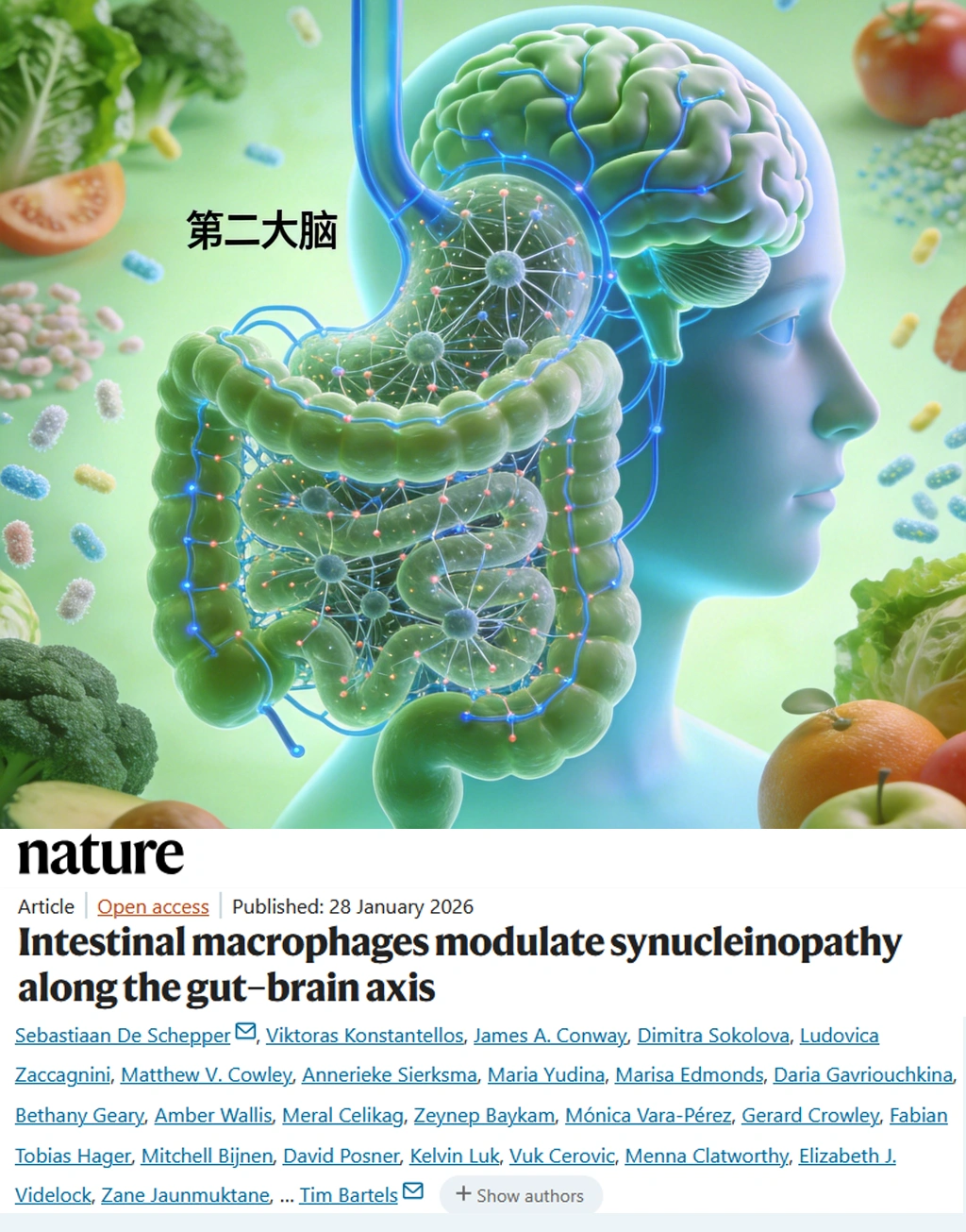 Nature重磅-帕金森病起源于肠道