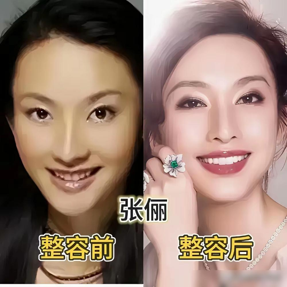 全网扒了十年沈梦辰整容，居然没人拿到实锤？
网友把她出道旧照和近照对比，从面部轮廓到鼻子眼睛，列了满满一串医美调整清单，连下巴假体的分析视频都传遍全网。
早年她上综艺回应过相关风波，全程自黑打哈哈，既没公开承认，也没站出来正面否认。
这么多年过去，她从头到尾没给过一句准话，所有说法全是第三方的