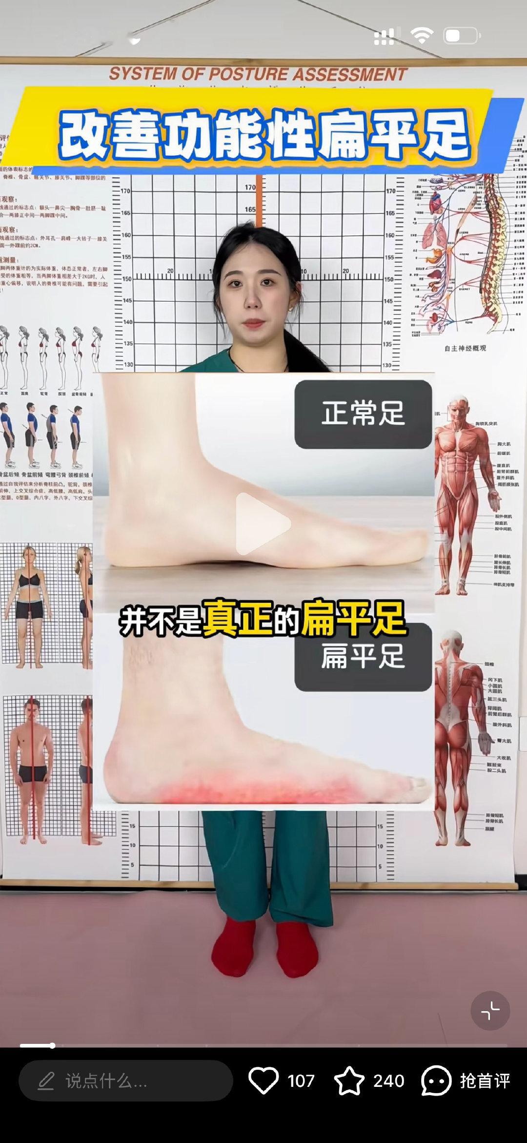 确定了张泽禹不是结构性扁平足（实打实无足弓）而是功能性扁平足（足弓时有时无） ​