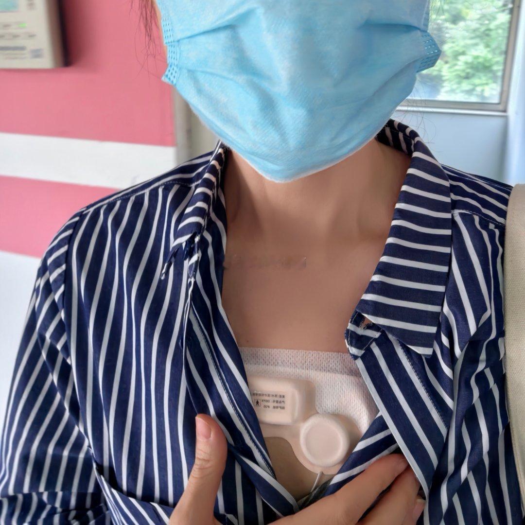 上周觉得心脏有一丢丢不舒服，搁年轻时候根本不在意，现在不行，这岁数怕有问题，就跑去看医生。

心电图、心脏彩超查一圈没发现任何问题，医生说戴个holter吧，怕查不出来，还给派了个48小时的。

现在holter真方便了，直接一块小芯片，和电极一起贴在前胸就行了。以前据说要背个盒子，想想都难受。

 ​