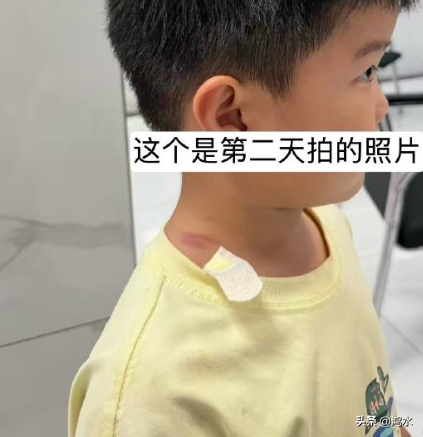 被指控摸臀男童父亲发声，根据男童父亲发布的调解记录可以看出，他们当天下午已经道歉了，但是，女方让他们书面道歉或者拍道歉视频，这是匪夷所思的，男童父母没有接受，而在第二天拍摄的照片中，依然清晰地看到男童脖子上的淤青，人家小男孩无心碰了一下，这个女大学生下手真狠。

在这件事情上，连中国妇女报都看不下去