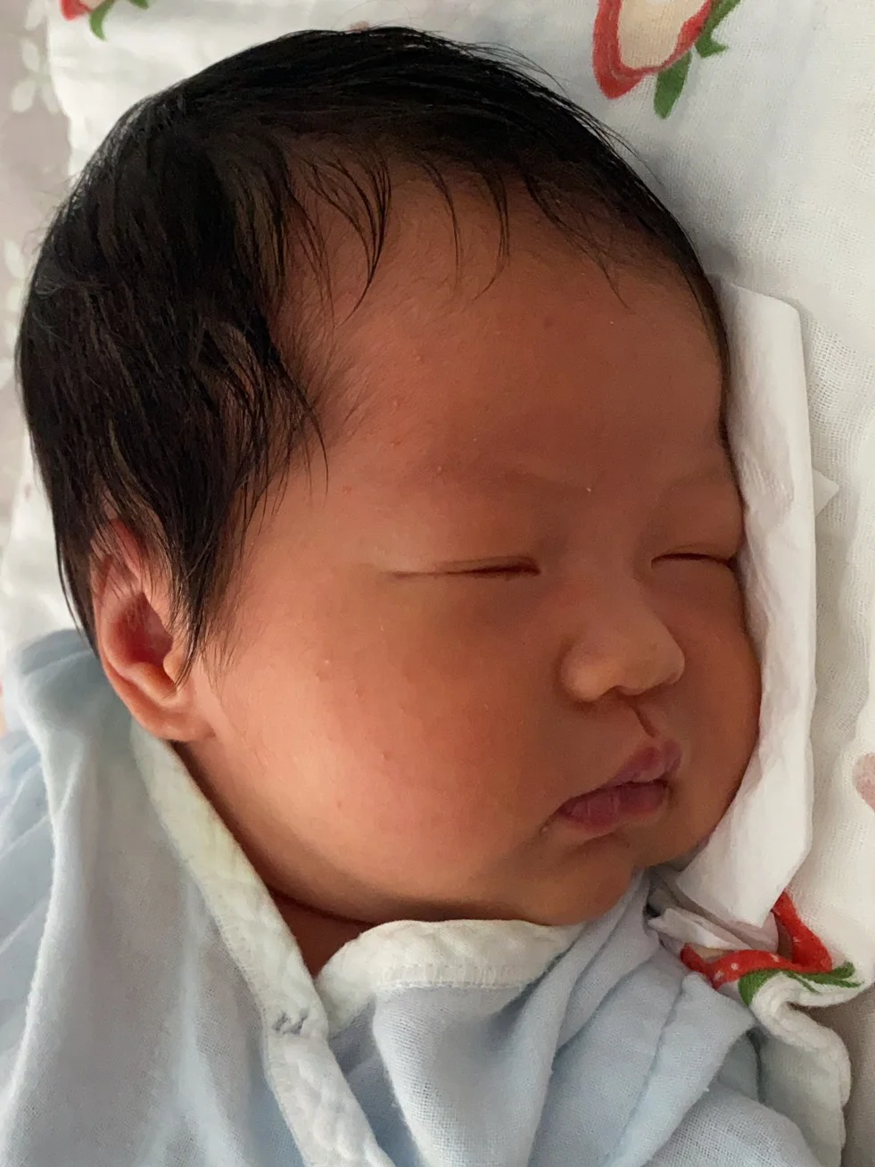 宝宝常见4大皮肤问题一篇讲透！新手宝妈必看