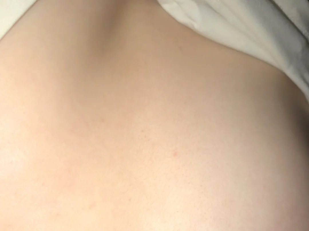 强推一个韩国的后背痘脱落剂