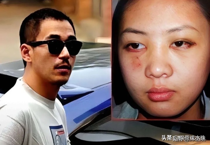 2003年，张国立的儿子张默，在中戏门口殴打女友童瑶，18岁的童瑶被打到跪地求饶：“歇10分钟再打吧！让我缓缓行吗？”没想到，张默接下来的举动，让她至今无法原谅。 
 
听见童瑶的求饶，张默半点停手的意思都没有，抬脚就踹在她的肩膀上，直接把人踹得摔在地上站不起来，拳头还不停往她身上落。

周围路过的