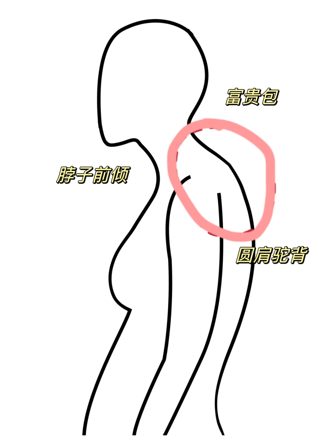 气质提升！圆肩驼背的姐妹冲！