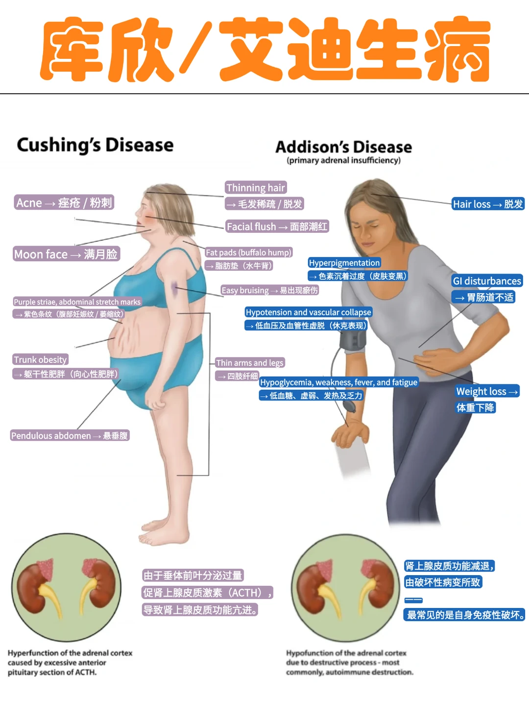 备考RN/库欣/艾迪生病！！学！！内容