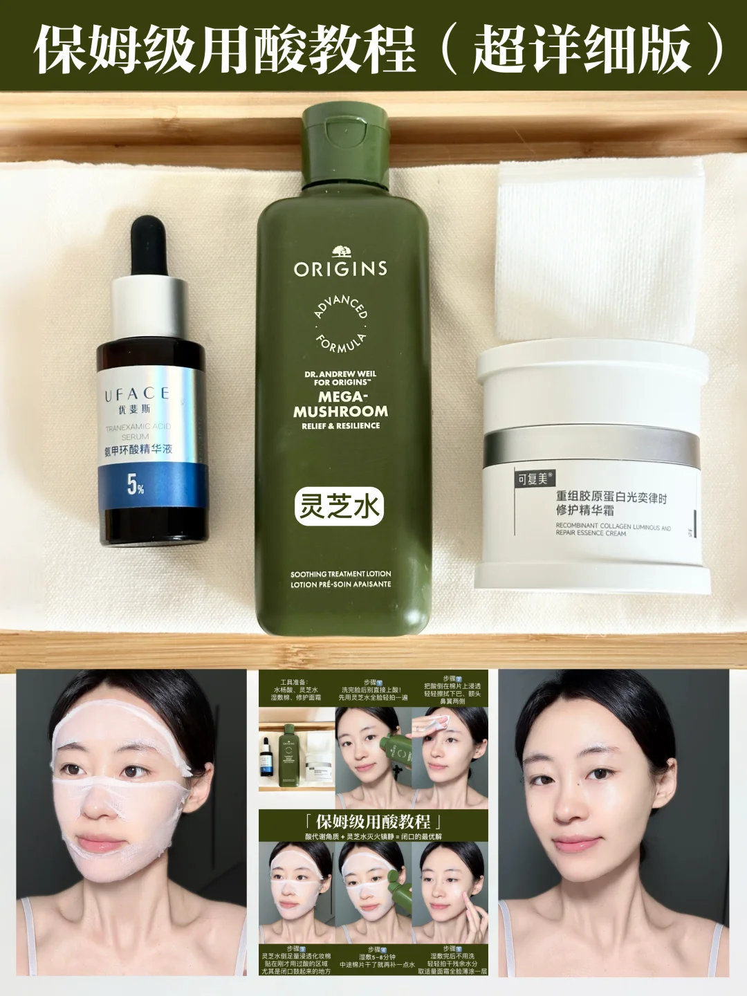 用酸后连敷灵芝水一周，闭口连根拔起