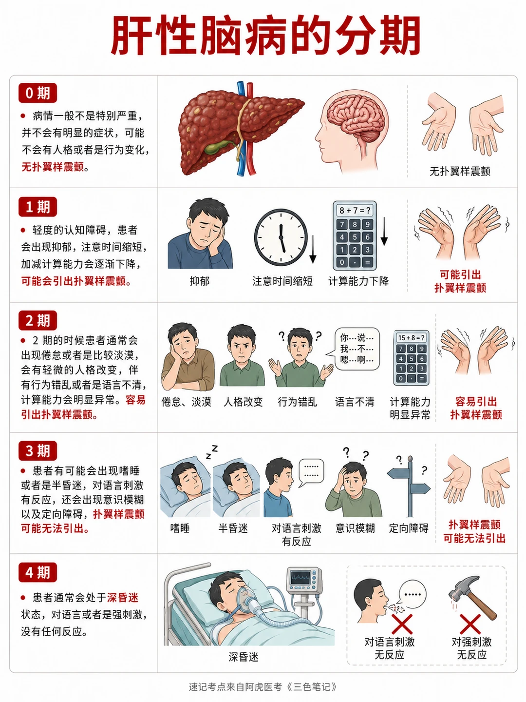 阿虎医考笔记📒肝性脑病分期❤️