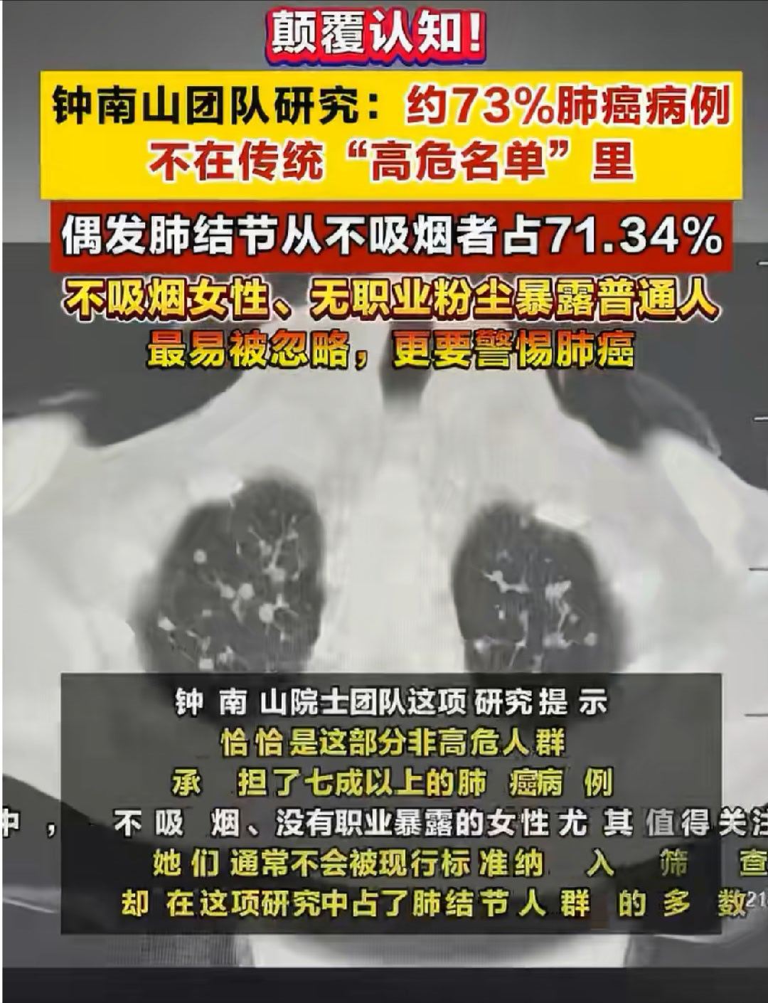 #钟南山团队发现肺结节发病新趋势#近几年的体检中，常常听到的是有了“肺结节”。问医生，医生回答：如今的CT机子越来越高级，成像效果越来越清晰…… ​